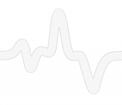 Clean self-intersecting corners of a pipe.