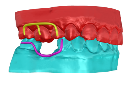 Corsi di formazione individuale in lingua italiana su Rhinoceros per la progettazione di dispositivi dentali.