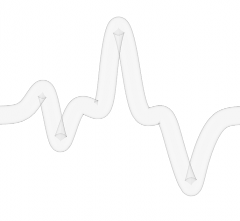 Clean self-intersecting corners of a pipe.