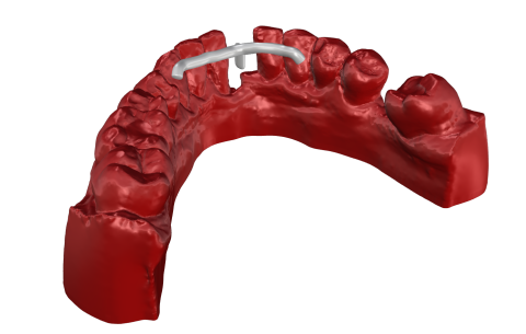 Corsi di formazione individuale in lingua italiana su Rhinoceros per la progettazione di dispositivi dentali.